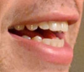 Picture of John Mulaney teeth and smile