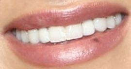 Picture of JoJo Fletcher teeth and smile