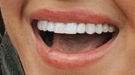 Picture of JoJo Fletcher teeth and smile