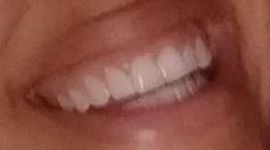 Picture of Jordan Alexander teeth and smile