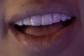 Picture of Jordan Alexander teeth and smile
