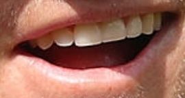 Picture of Jordan Spieth teeth and smile