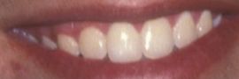 Picture of Jordi Vilasuso teeth and smile