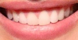 Picture of Josephine Skriver teeth and smile
