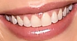 Picture of Josephine Skriver teeth and smile