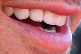 Picture of Josh Duhamel teeth and smile