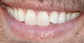 Picture of Joshua Morrow teeth and smile
