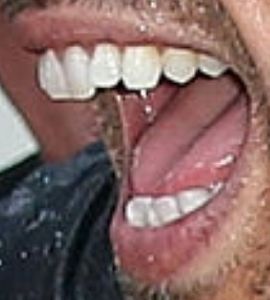 Picture of Joshua Morrow teeth and smile