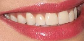 Picture of Joyce Giraud teeth and smile