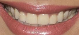 Picture of Joyce Giraud teeth and smile