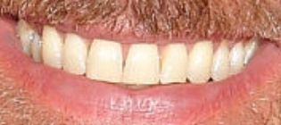 Picture of Jude Law teeth and smile
