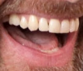 Picture of Jude Law teeth and smile