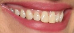 image of Julia Roberts teeth and smile