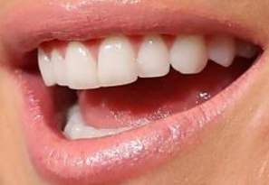 Julianne Hough teeth