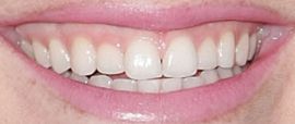 Picture of Julie Berman teeth and smile