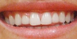 Picture of Julie Berman teeth and smile