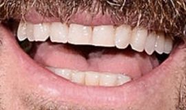 Picture of Justin Theroux teeth and smile