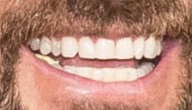 Picture of Justin Theroux teeth and smile