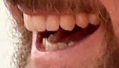 Justin Timberlake's teeth