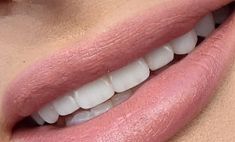 Picture of Kacey Musgraves teeth and smile