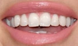 Picture of Kaitlyn Bristowe teeth and smile