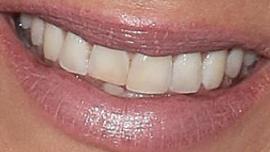 Picture of Kaley Cuoco teeth and smile
