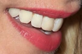 Picture of Kaley Cuoco teeth and smile
