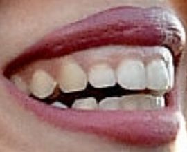 Picture of Kali Uchis teeth and smile
