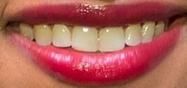 Picture of Kara McCullough teeth and smile