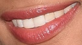 Picture of Kara McCullough teeth and smile