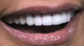 Picture of Karen Huger teeth and smile