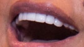 Picture of Karen Huger teeth and smile