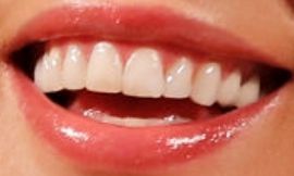 Picture of Kate Beckinsale teeth and smile