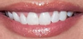 Picture of Kate Chastain teeth and smile
