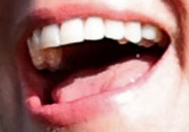 Picture of Kate Middleton teeth and smile