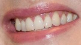 Picture of Kate Winslet teeth and smile