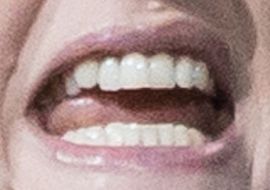 Picture of Kate Winslet teeth and smile