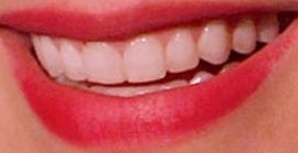 Picture of Katharine McPhee teeth and smile