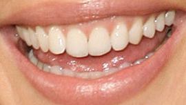 Picture of Katherine Heigl teeth and smile