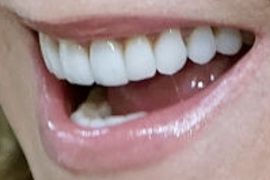 Picture of Kathie Lee Gifford teeth and smile
