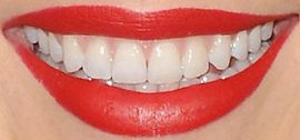 Picture of Katie Cassidy teeth and smile