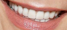 Katie Holmes teeth