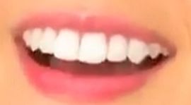 Picture of Katie Thurston teeth and smile