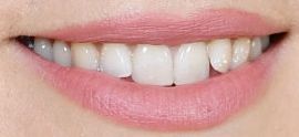 Picture of Keira Knightley teeth and smile