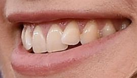 Picture of Keira Knightley teeth and smile