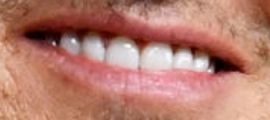 Picture of Keith Urban's teeth and smile while smiling