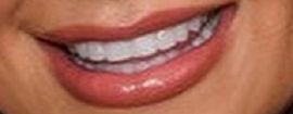 Picture of Kelley Flanagan teeth and smile