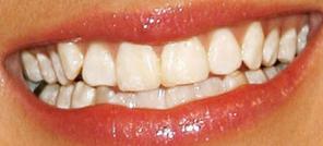 Picture of Kellie Pickler teeth and smile
