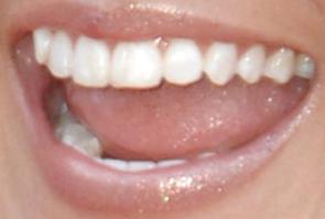 Picture of Kellie Pickler teeth and smile