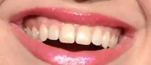 Picture of Kelly Clarkson's teeth and smile